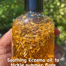 Load image into Gallery viewer, Soothing Eczema Oil